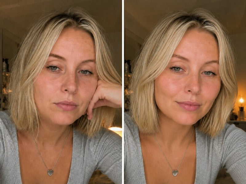 NIVAROQ Vorher-Nachher Hautpflegevergleich mit sichtbar frischeren Gesichtskonturen und gepflegtem Hautbild für mehr Vertrauen im Alltag