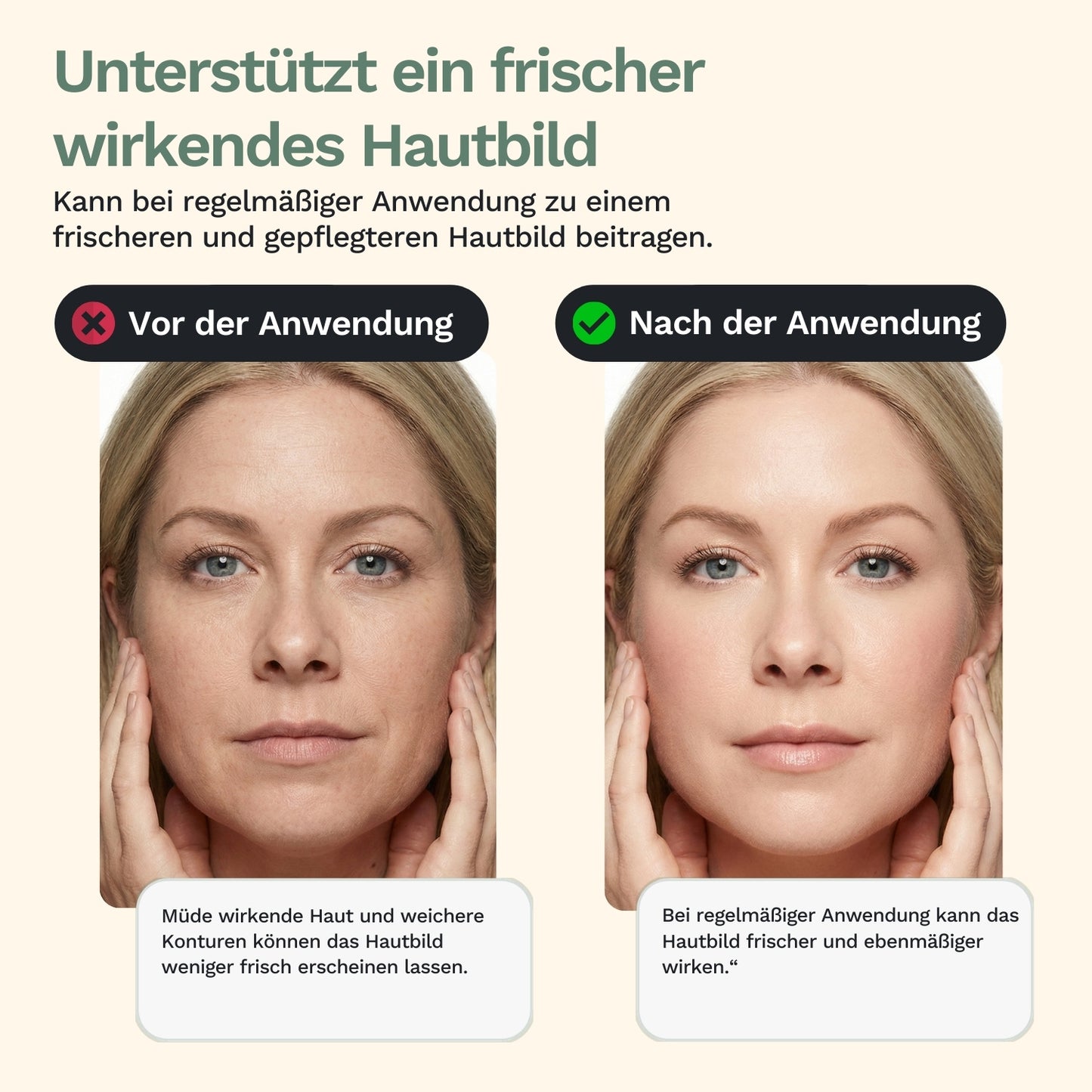 Rolandus G1 - masažer za obraz